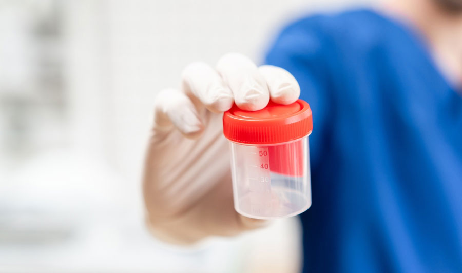 Semen Analysis at Miracle IVF Hospital, Bangalore.